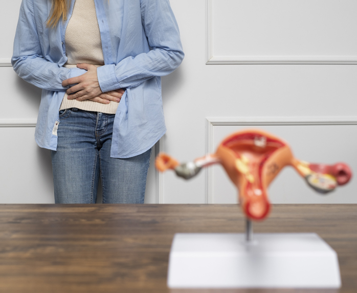 Miomas uterinos
